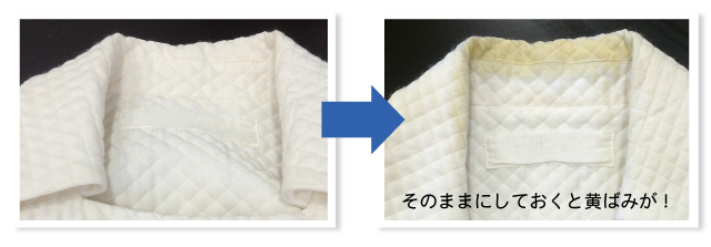 黄ばみBA