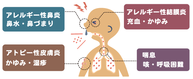 ダニの健康被害